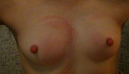 Tits Punished With A Fly Swatter