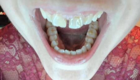 Big dirty teeth for a little man avi