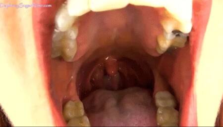 * 854x480p * Close up Long Hold Yawns - Mp4