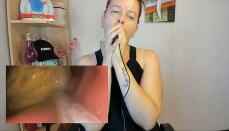 The stone of the fruit - Endoscope vore