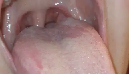 452px x 259px - Mouth Fetish Throat Fetish Porn Videos (8) - FAPSTER