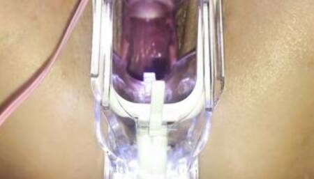 Japanese Cunt With Speculum,Masturbating.