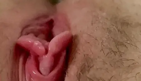 Cervix Prolapse Porn - Cervix Prolapse Porn Videos (7) - FAPSTER