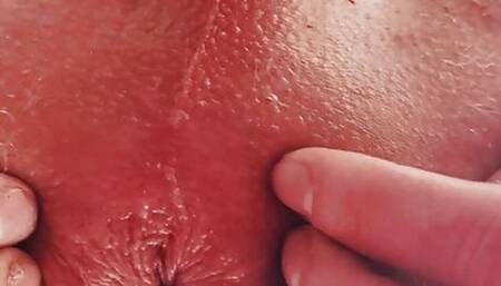 Close Up of my destroyed asshole.