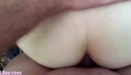 Anal Forest
