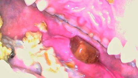 CUSTOM Ugly Chewing & Endoscope