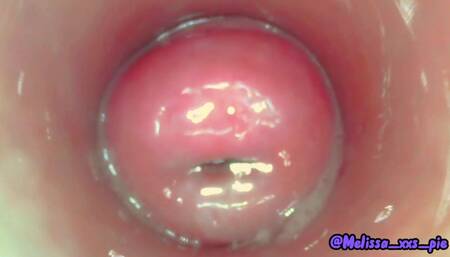 Masturbation with Camera Inside the Pussy | Cervix | Pussycam Endoscope Version - Teaser - Xxs Pie