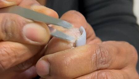 DeCrusting Of De'Feet