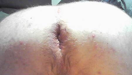 Anal Treating My Ass