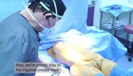 mommy makeover compilation