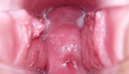 Cervix Display and Speculum Play