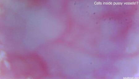 Cells moving inside pussy vessels!