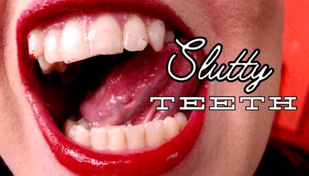 Slutty Teeth - MP4