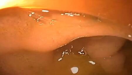 The complete medical examination by the doctor 4K