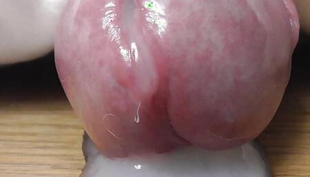 Magicprostate