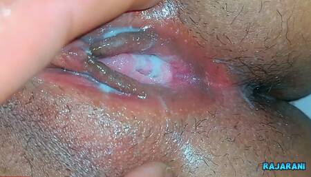 Best Homemade Sex With Condom Cumshot