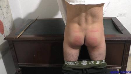 up close and painful luis 4