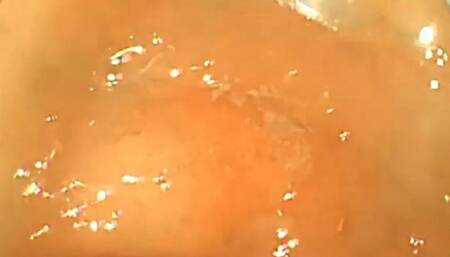 The doctor explores my belly full of meat to digest - FullScreen Exploration 4K