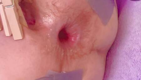 Duct Tape and Anal Gape