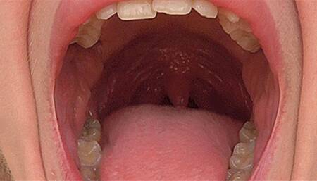 Huge mouth with a yawn! MP4