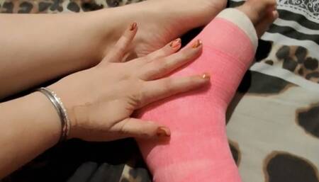 I treat my hurt and broken leg very good with some soft creme