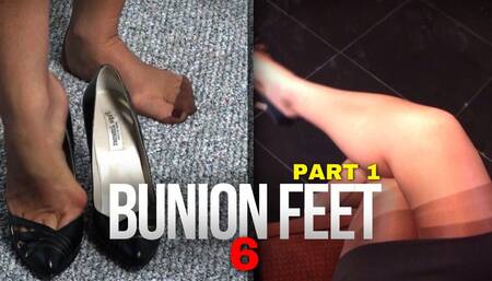 Fetish207 - Foot Fantasies, Bunion Feet 6, Part 1