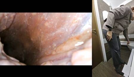 An Unexpected Exploration: Ingesting a PillCam for a Fascinating Journey Through My Own Anatomy 1080HD