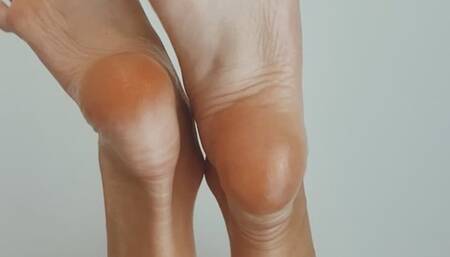 Wrinkled soles up