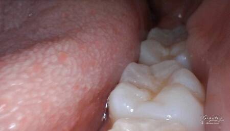 Macro vore endoscope mouth tour 2