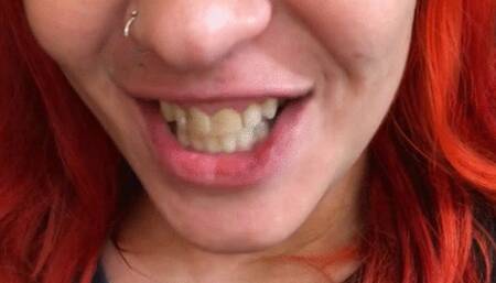 Mouth tour 2 - Rotten teeth, yellow tongue while smoking