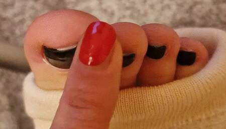 sweet toes in cast and how she frees the foot