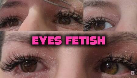 Long Lashes, Itchy Eyes and Skin Picking with a Tweezer