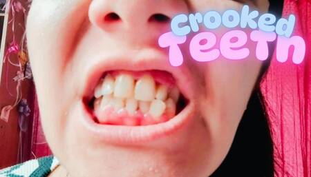Cleaning my crooked teeth
