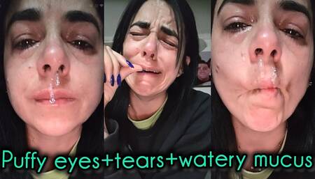 Puffy eyes+tears+watery mucus!