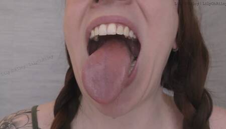 Glasses & Gape: 11-min Dental Speculum-Stretched Drool Session (WMV)