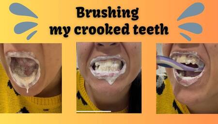 BRUSHING MY CROOKED TEETH