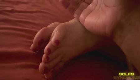 Soles Syndrome