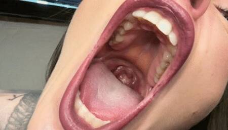 Longest insane yawning