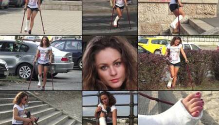 Zuzu Term SLWC Summer Crutch and Unexpected Sunburn with Foot Play (in HD 1920X1080