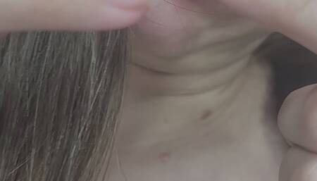 removing acne from my face and ears