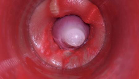 Camera Inside Pussy: Powerfull Cum in Pussy! Best Internal Asmr in 4K More Sperm