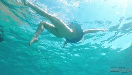 375 - Tricia got a Sunstroke!