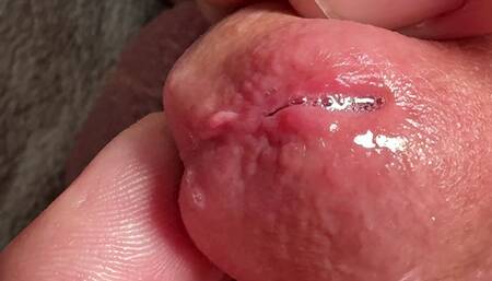 Fingers in the Penis. Hole in Penis Penetration.