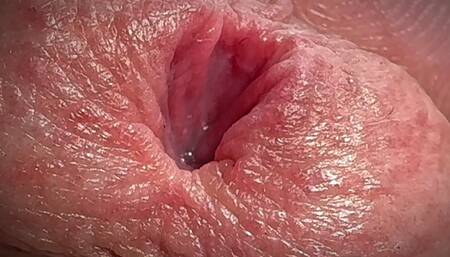 Peeing on the Testicles