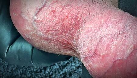 My Balls Are Punished