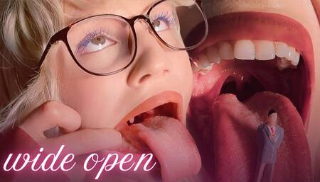 Wide Open Up Close Mouth View