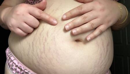 Stretch Mark Tour 2025 Update