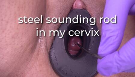 steel sounding rod in my cervix