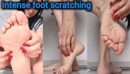Intense foot scratching