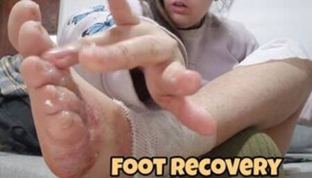 Foot Bandaging and Itchy Feet Problem – Close-Up Healing and Wrapping Session for Foot Fetishists